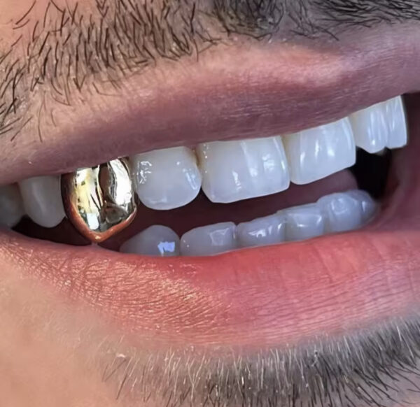 Grillz - Image 2