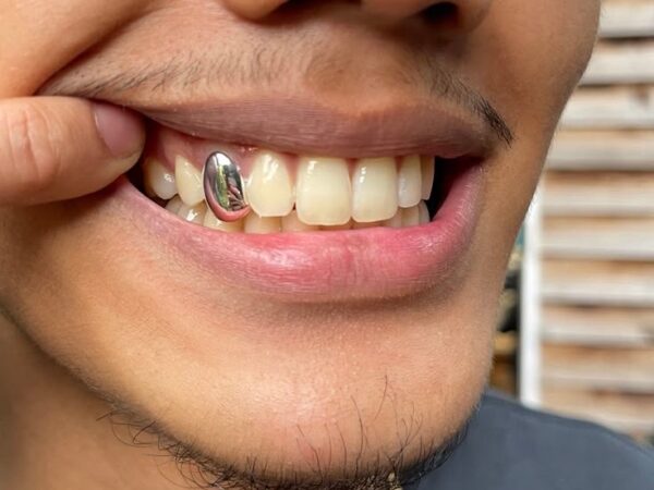 Grillz